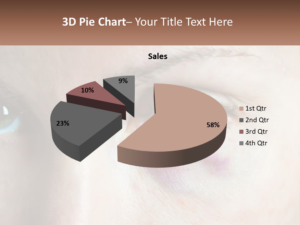 A Person With A Bruised Eye Has A Name Of Presentation PowerPoint Template