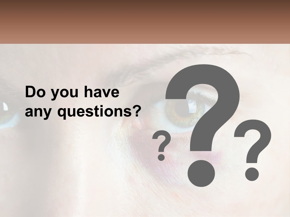 A Person With A Bruised Eye Has A Name Of Presentation PowerPoint Template