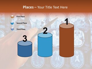 A Person Holding A Pen In Front Of Mri Images PowerPoint Template