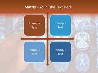 A Person Holding A Pen In Front Of Mri Images PowerPoint Template