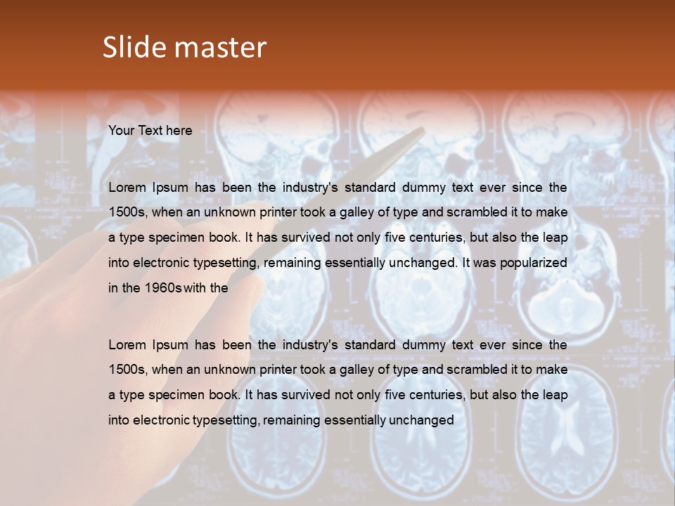 A Person Holding A Pen In Front Of Mri Images PowerPoint Template