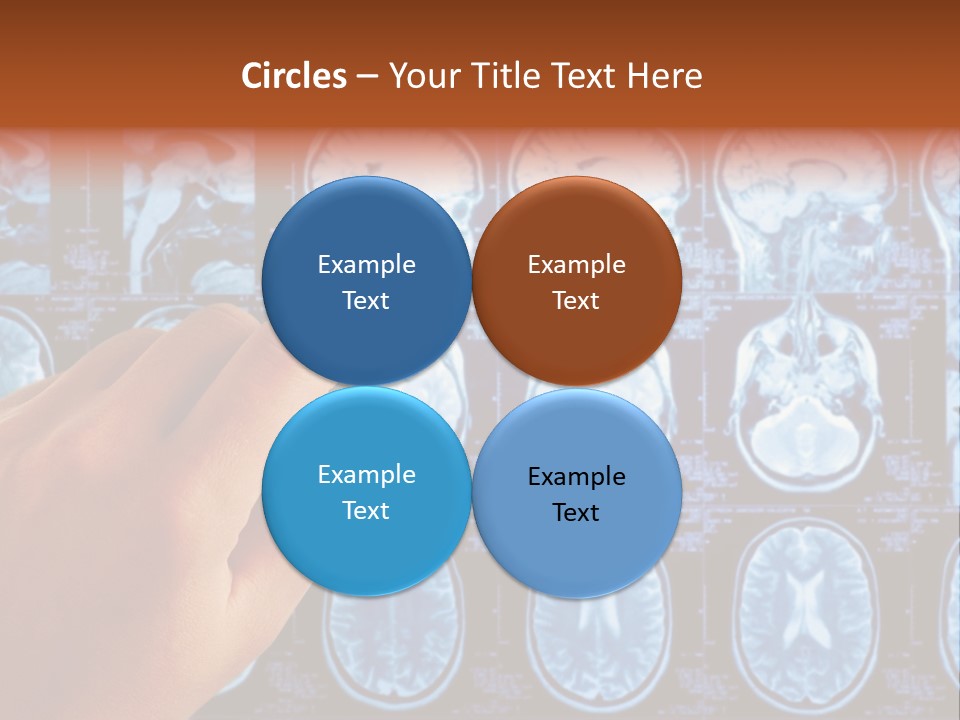 A Person Holding A Pen In Front Of Mri Images PowerPoint Template