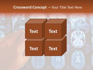 A Person Holding A Pen In Front Of Mri Images PowerPoint Template