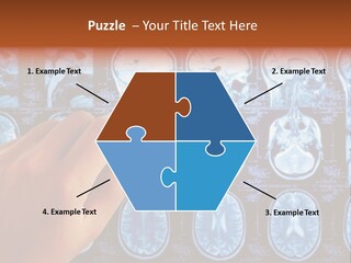 A Person Holding A Pen In Front Of Mri Images PowerPoint Template