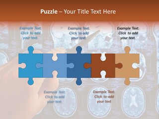 A Person Holding A Pen In Front Of Mri Images PowerPoint Template