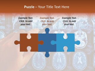 A Person Holding A Pen In Front Of Mri Images PowerPoint Template