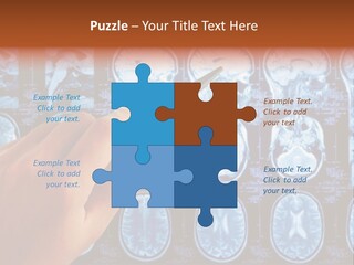 A Person Holding A Pen In Front Of Mri Images PowerPoint Template