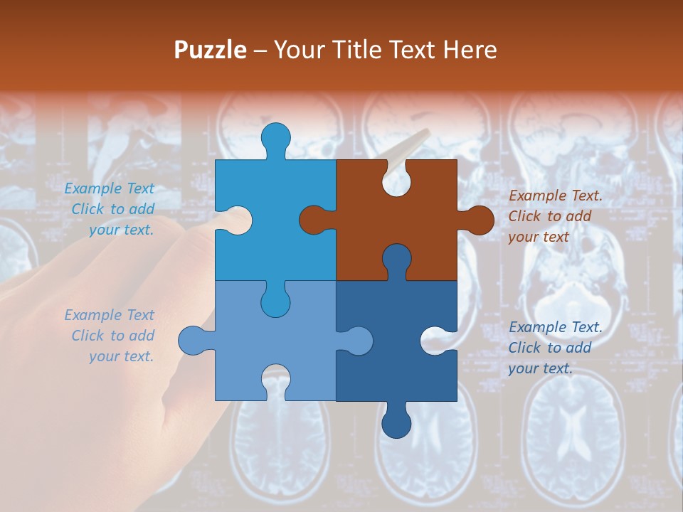 A Person Holding A Pen In Front Of Mri Images PowerPoint Template
