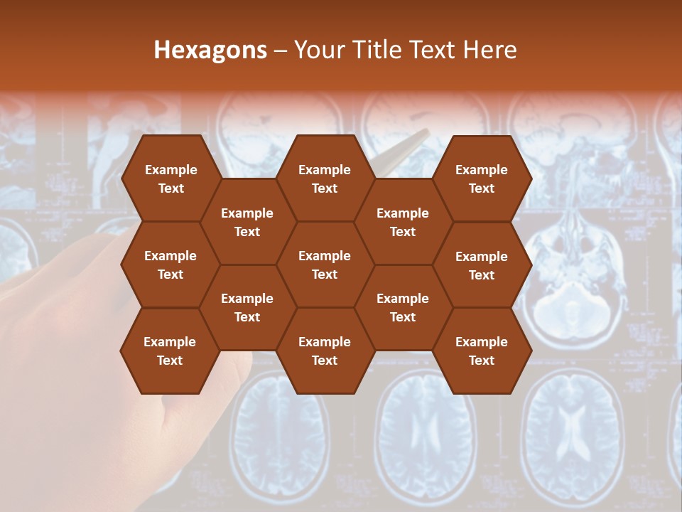 A Person Holding A Pen In Front Of Mri Images PowerPoint Template