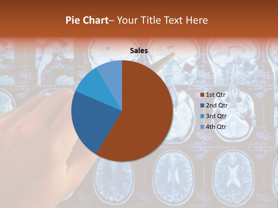 A Person Holding A Pen In Front Of Mri Images PowerPoint Template