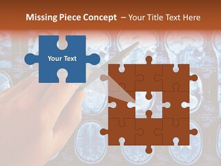 A Person Holding A Pen In Front Of Mri Images PowerPoint Template