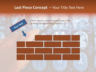 A Person Holding A Pen In Front Of Mri Images PowerPoint Template