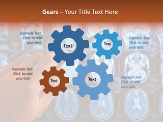 A Person Holding A Pen In Front Of Mri Images PowerPoint Template