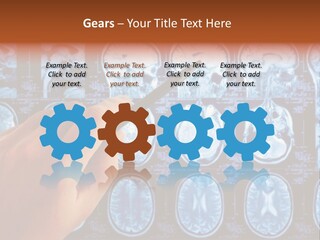 A Person Holding A Pen In Front Of Mri Images PowerPoint Template
