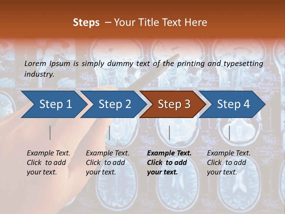 A Person Holding A Pen In Front Of Mri Images PowerPoint Template