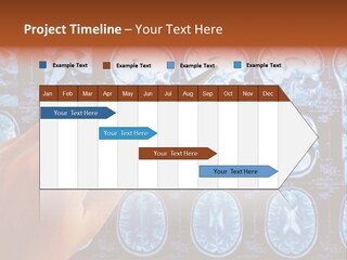 A Person Holding A Pen In Front Of Mri Images PowerPoint Template
