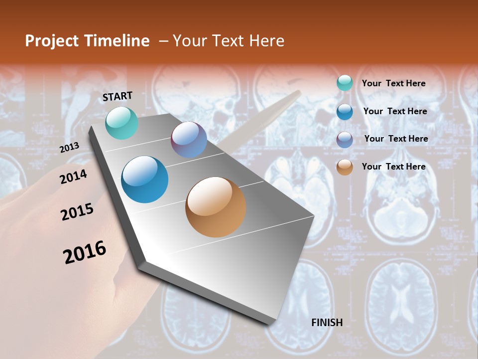 A Person Holding A Pen In Front Of Mri Images PowerPoint Template