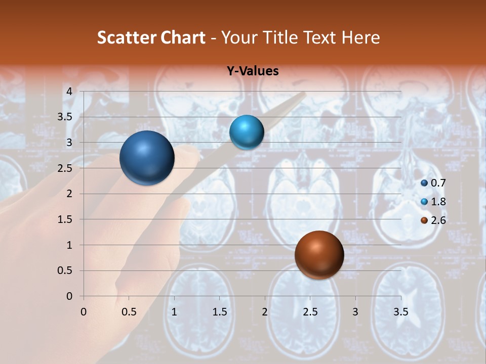 A Person Holding A Pen In Front Of Mri Images PowerPoint Template
