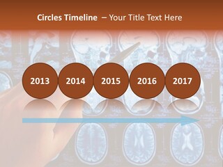 A Person Holding A Pen In Front Of Mri Images PowerPoint Template