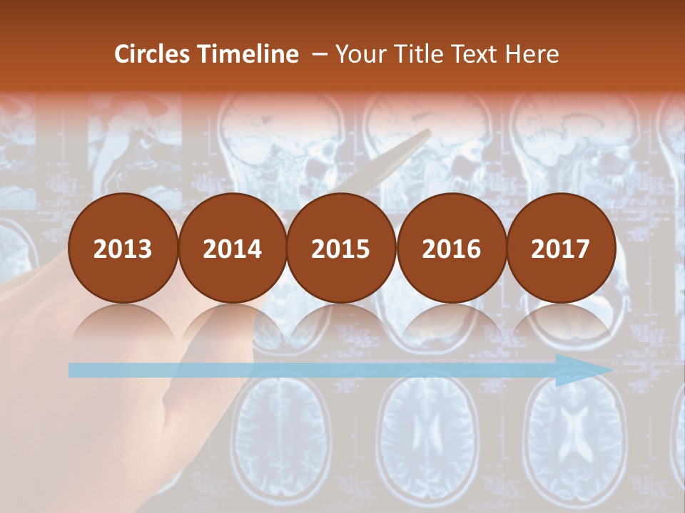 A Person Holding A Pen In Front Of Mri Images PowerPoint Template