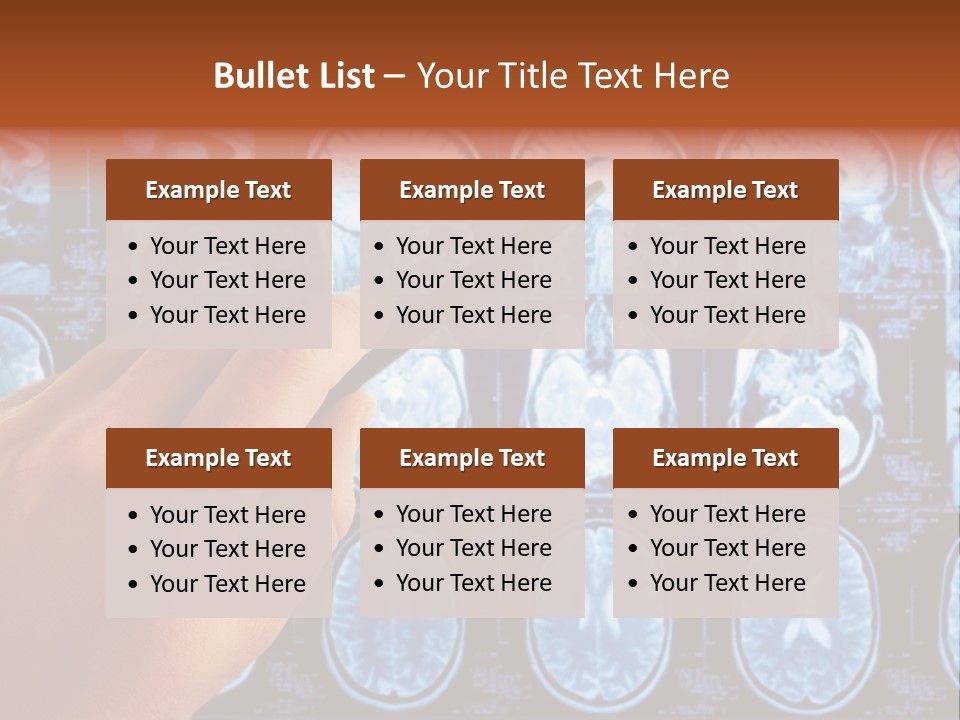 A Person Holding A Pen In Front Of Mri Images PowerPoint Template