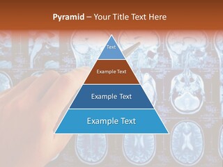 A Person Holding A Pen In Front Of Mri Images PowerPoint Template