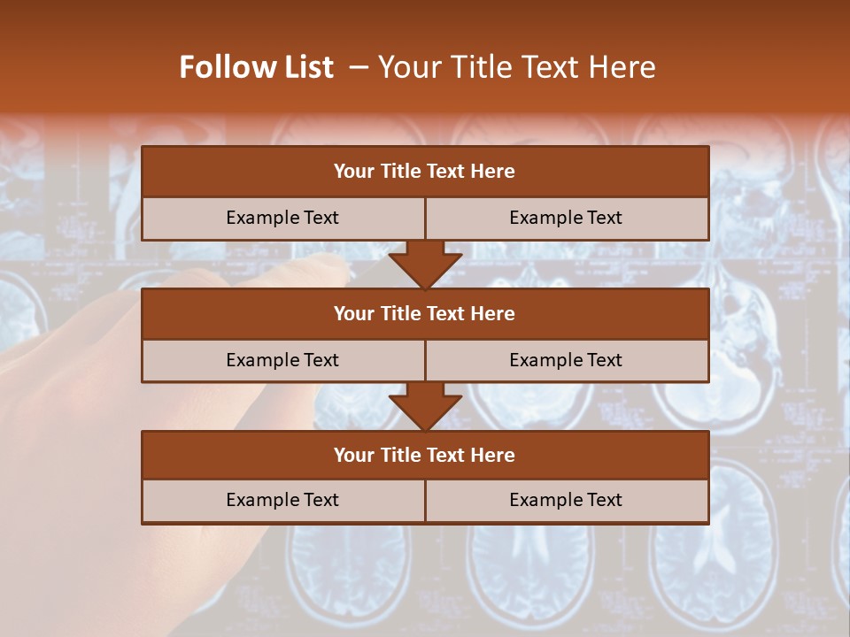 A Person Holding A Pen In Front Of Mri Images PowerPoint Template