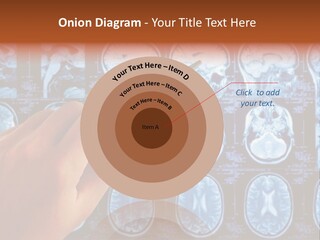 A Person Holding A Pen In Front Of Mri Images PowerPoint Template