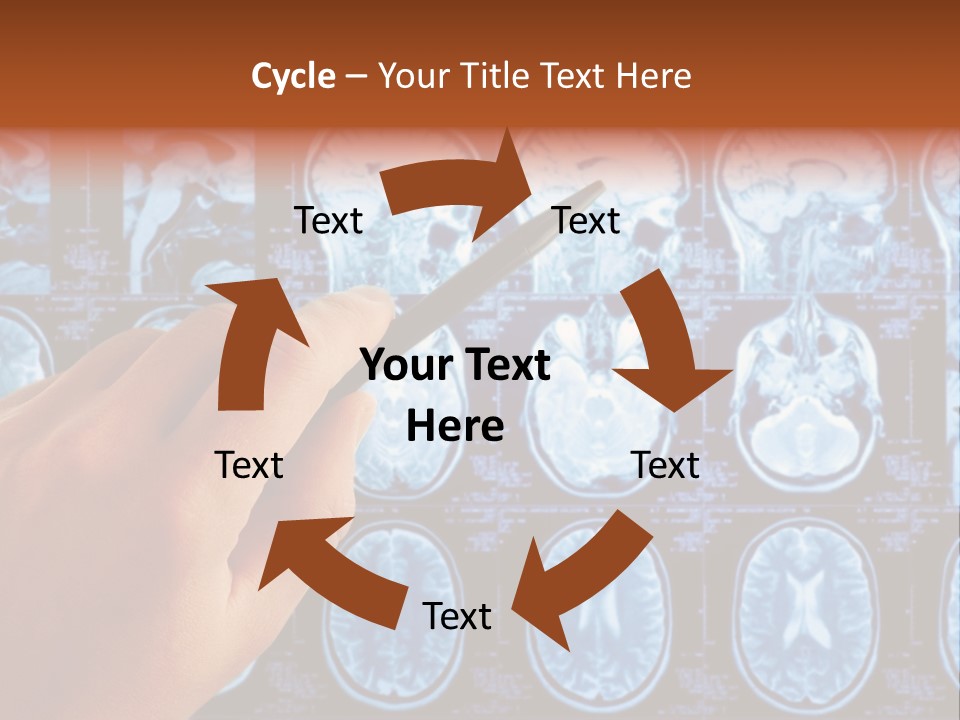 A Person Holding A Pen In Front Of Mri Images PowerPoint Template