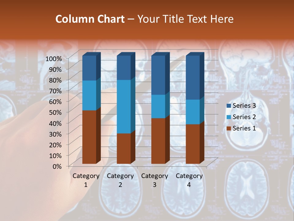 A Person Holding A Pen In Front Of Mri Images PowerPoint Template