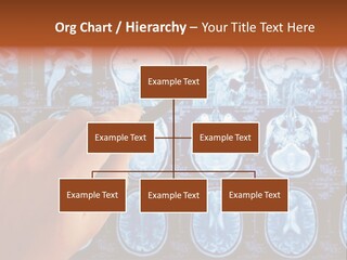 A Person Holding A Pen In Front Of Mri Images PowerPoint Template