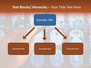 A Person Holding A Pen In Front Of Mri Images PowerPoint Template