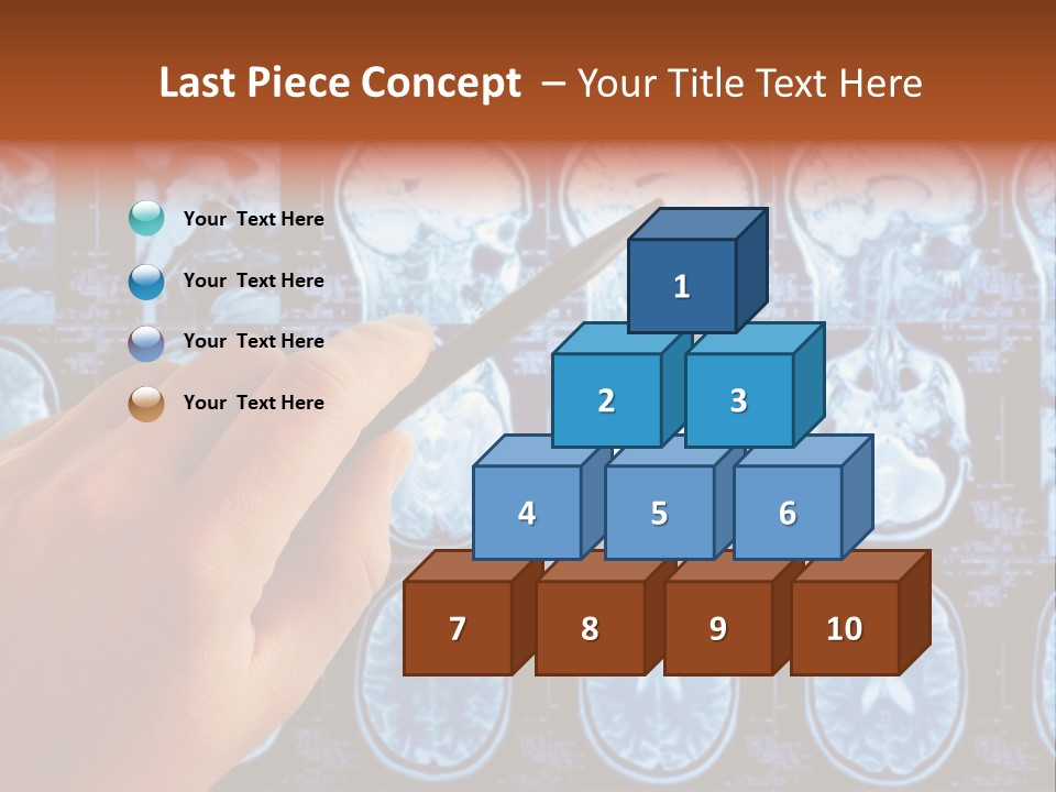 A Person Holding A Pen In Front Of Mri Images PowerPoint Template