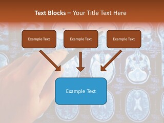 A Person Holding A Pen In Front Of Mri Images PowerPoint Template