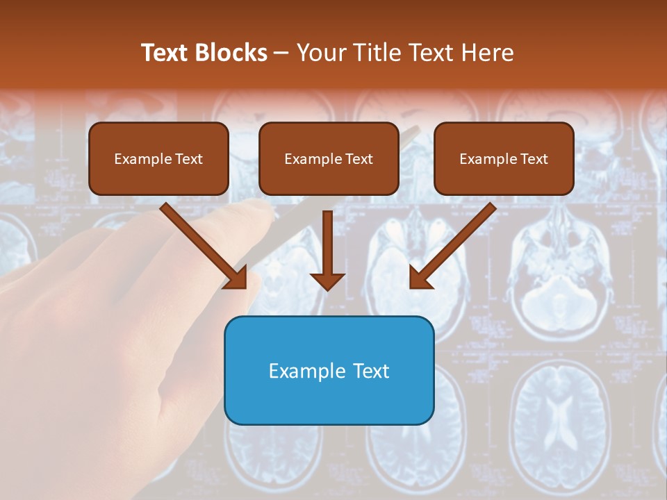 A Person Holding A Pen In Front Of Mri Images PowerPoint Template