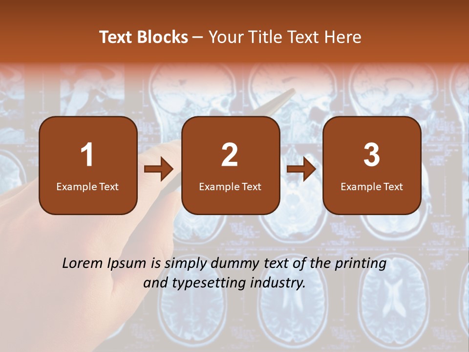 A Person Holding A Pen In Front Of Mri Images PowerPoint Template