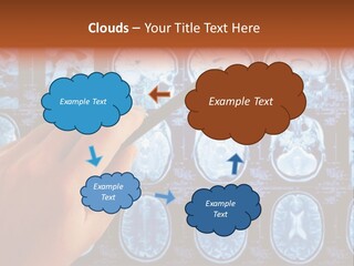 A Person Holding A Pen In Front Of Mri Images PowerPoint Template