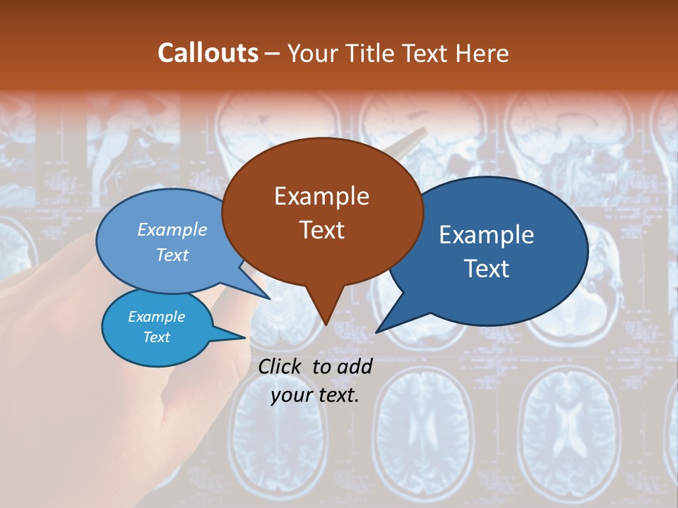 A Person Holding A Pen In Front Of Mri Images PowerPoint Template