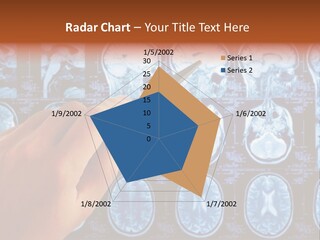 A Person Holding A Pen In Front Of Mri Images PowerPoint Template