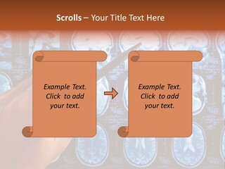 A Person Holding A Pen In Front Of Mri Images PowerPoint Template