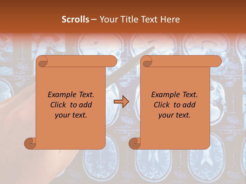 A Person Holding A Pen In Front Of Mri Images PowerPoint Template