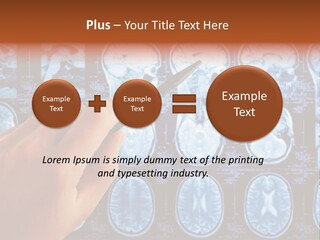 A Person Holding A Pen In Front Of Mri Images PowerPoint Template