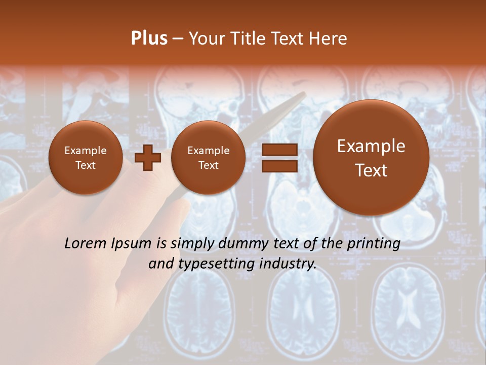 A Person Holding A Pen In Front Of Mri Images PowerPoint Template