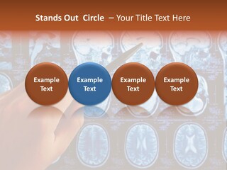 A Person Holding A Pen In Front Of Mri Images PowerPoint Template