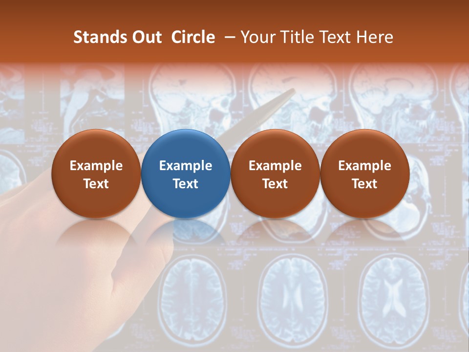 A Person Holding A Pen In Front Of Mri Images PowerPoint Template