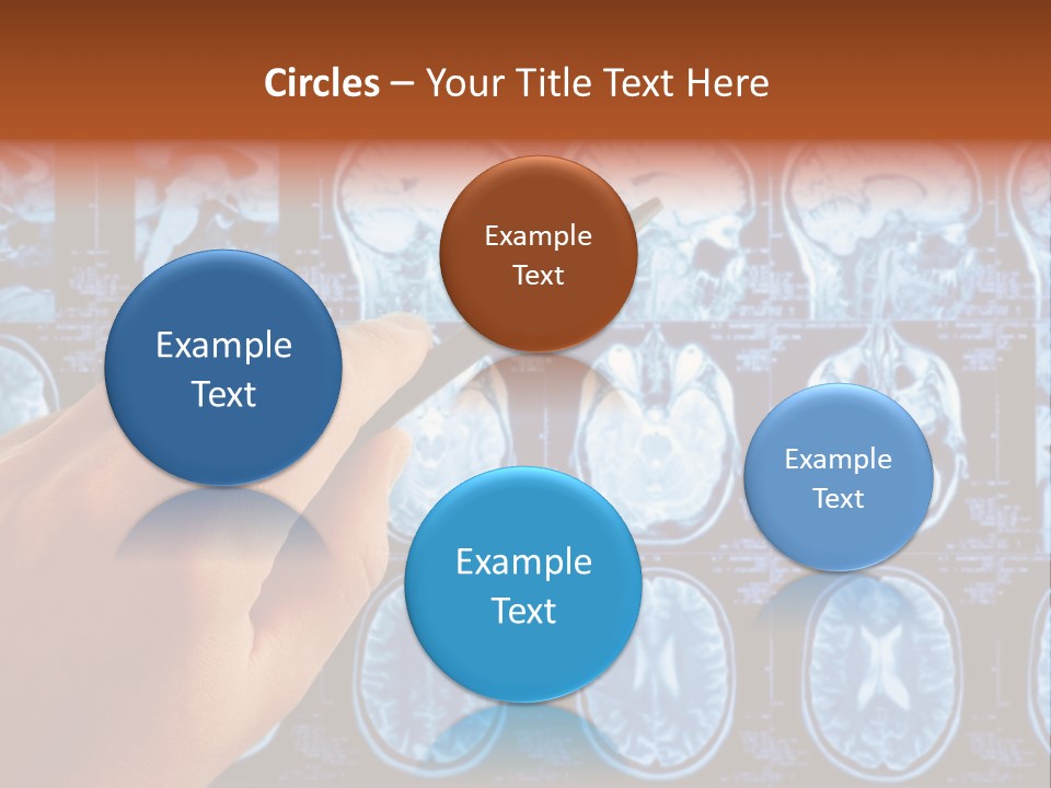 A Person Holding A Pen In Front Of Mri Images PowerPoint Template