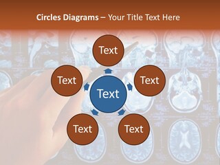 A Person Holding A Pen In Front Of Mri Images PowerPoint Template