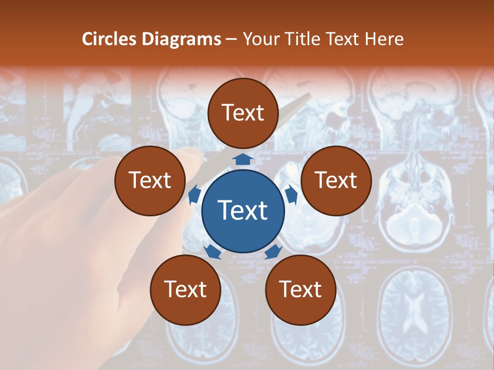 A Person Holding A Pen In Front Of Mri Images PowerPoint Template