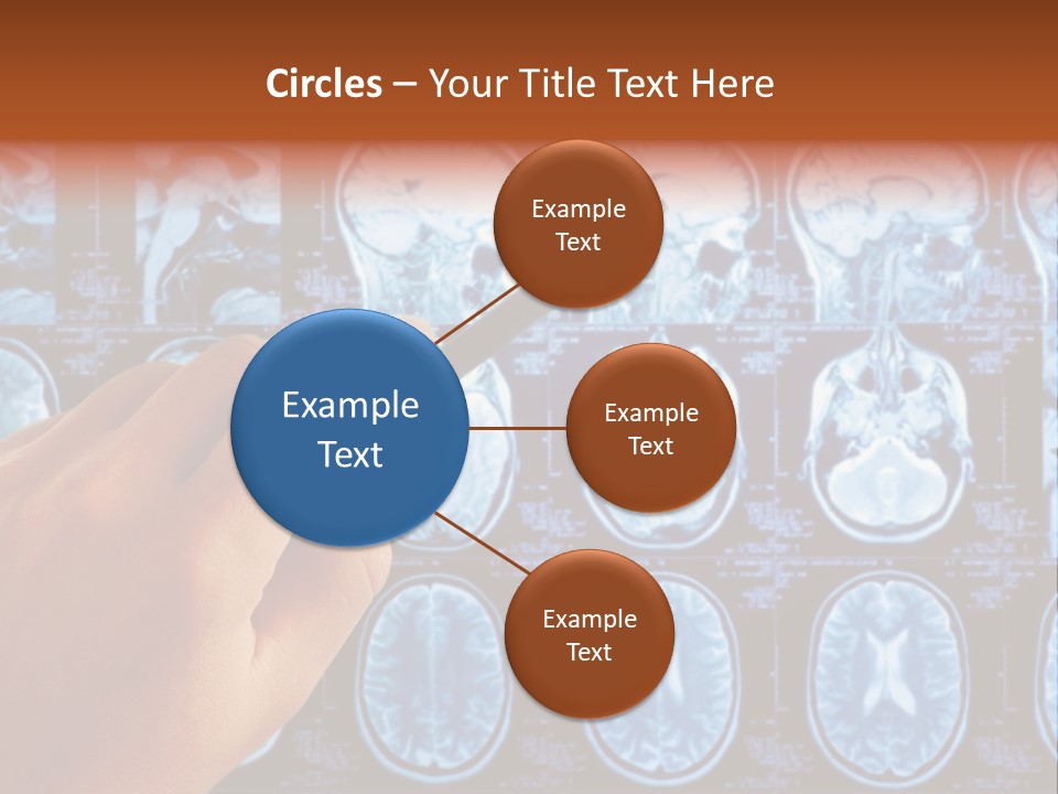 A Person Holding A Pen In Front Of Mri Images PowerPoint Template