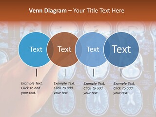 A Person Holding A Pen In Front Of Mri Images PowerPoint Template